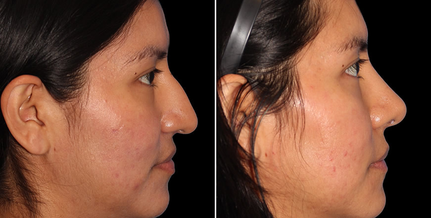 Plastic Surgery Results